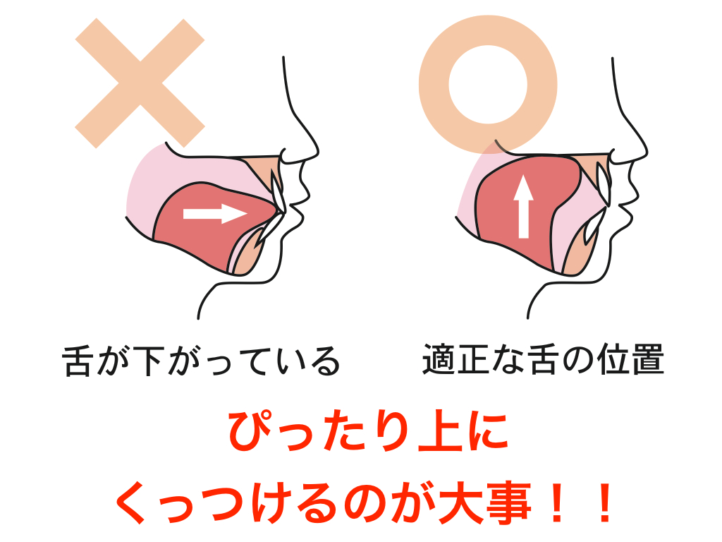 🦷「お口ぽかん」について🦷